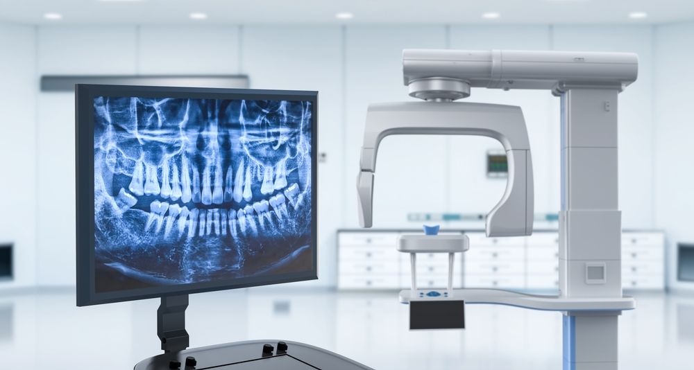 Digital Dental X-Ray