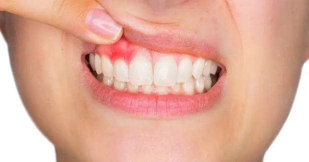Periodontal Treatment