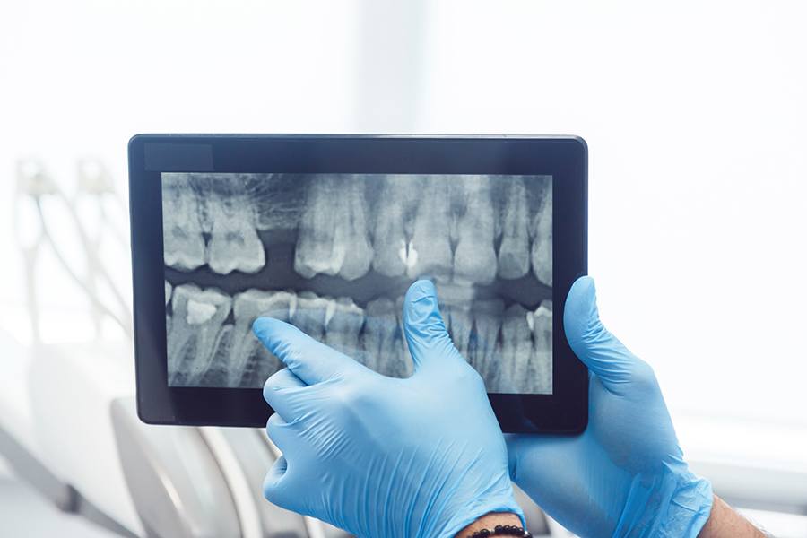 Reviewing X-Ray