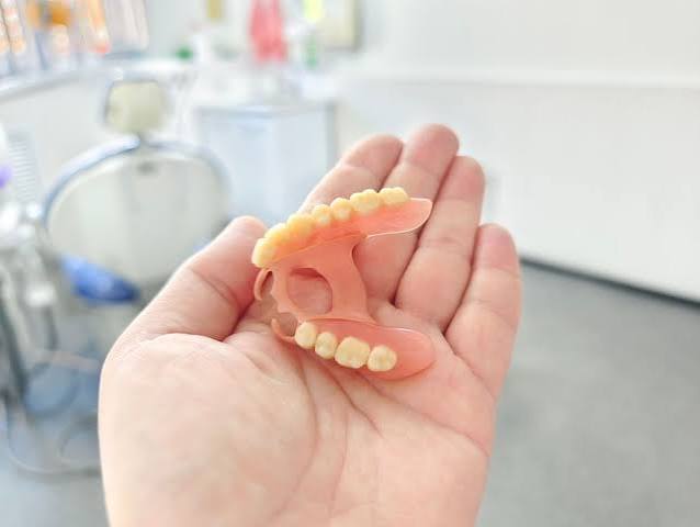 Partial Denture